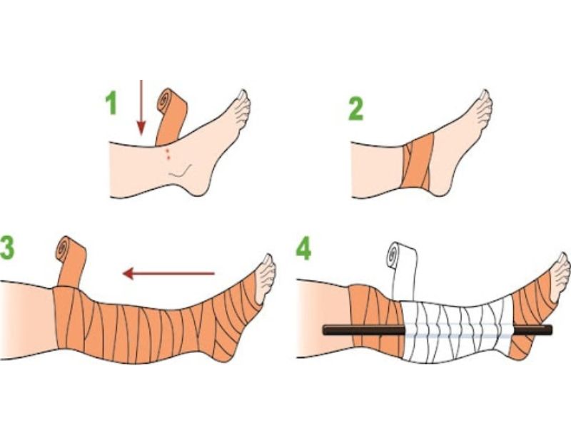 Tránh cử động mạnh để hạn chế nọc độc lan nhanh