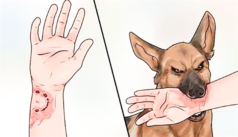 Bệnh dại từ chó thả rông